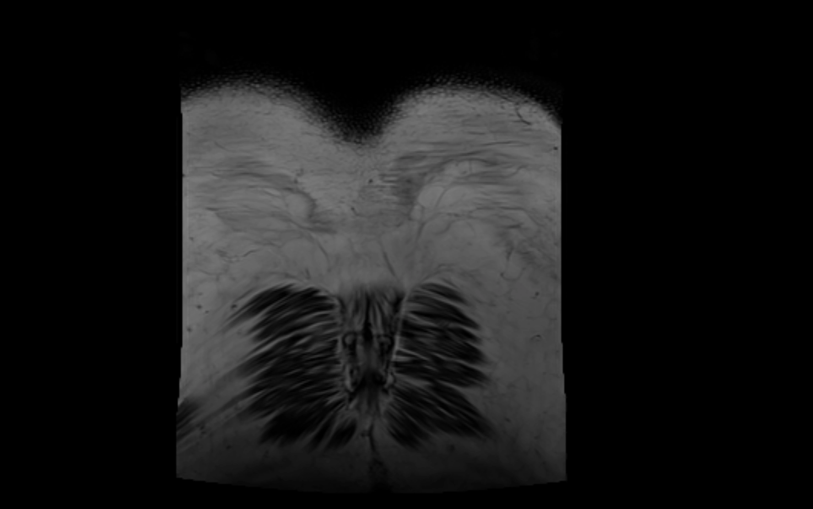 MR lumbosacral plexus cross sectional anatomy 3T  radiology  image-img-09001-00089.webp